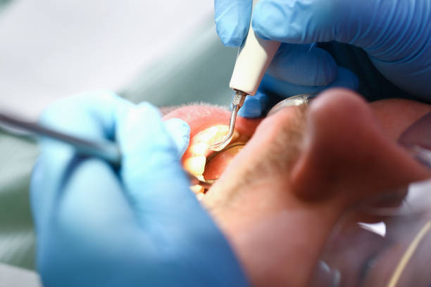 Best Weekend Emergency Dentist in Rendon, TX